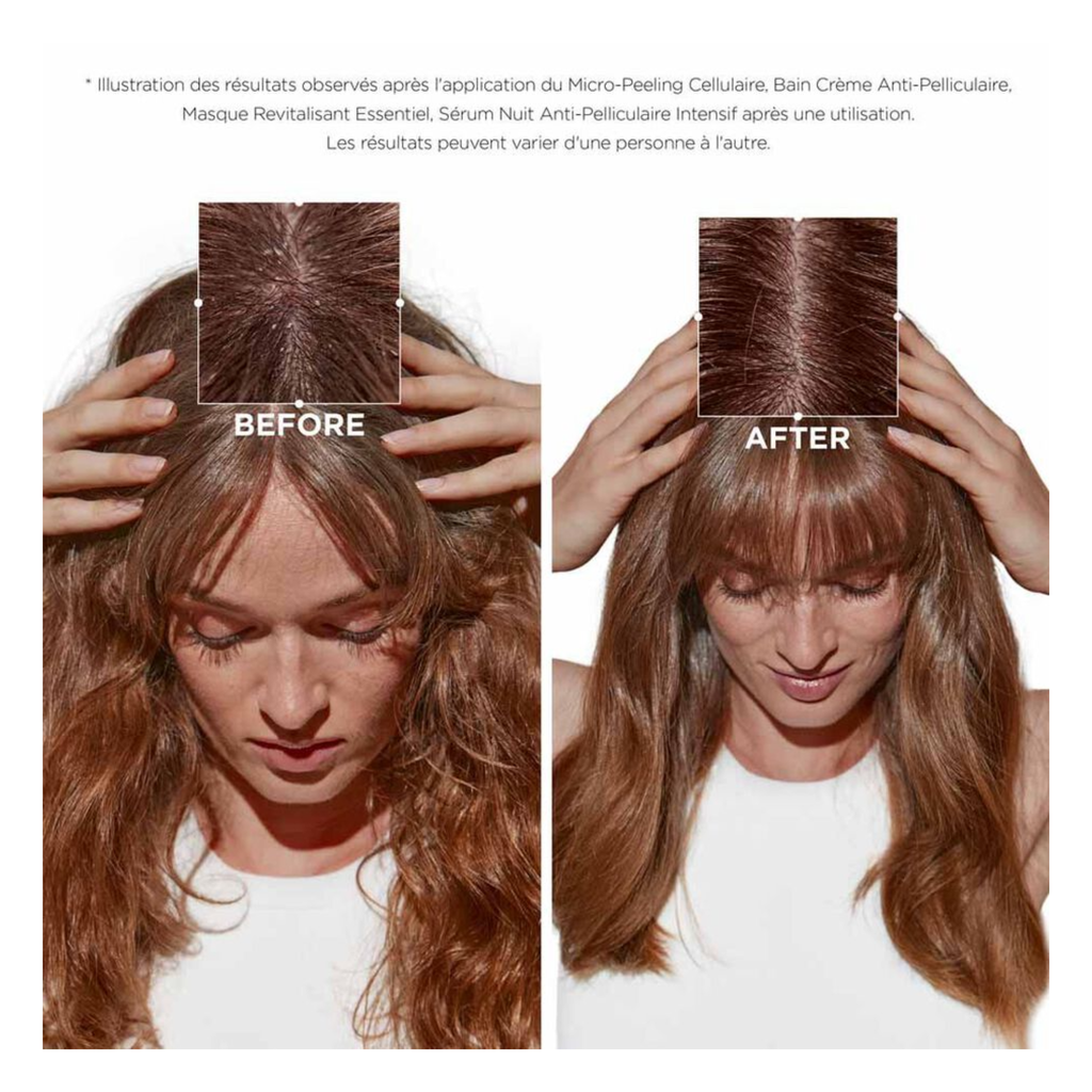 Kérastase - Bain crème anti-pelliculaire - 250 ML KERASTASE