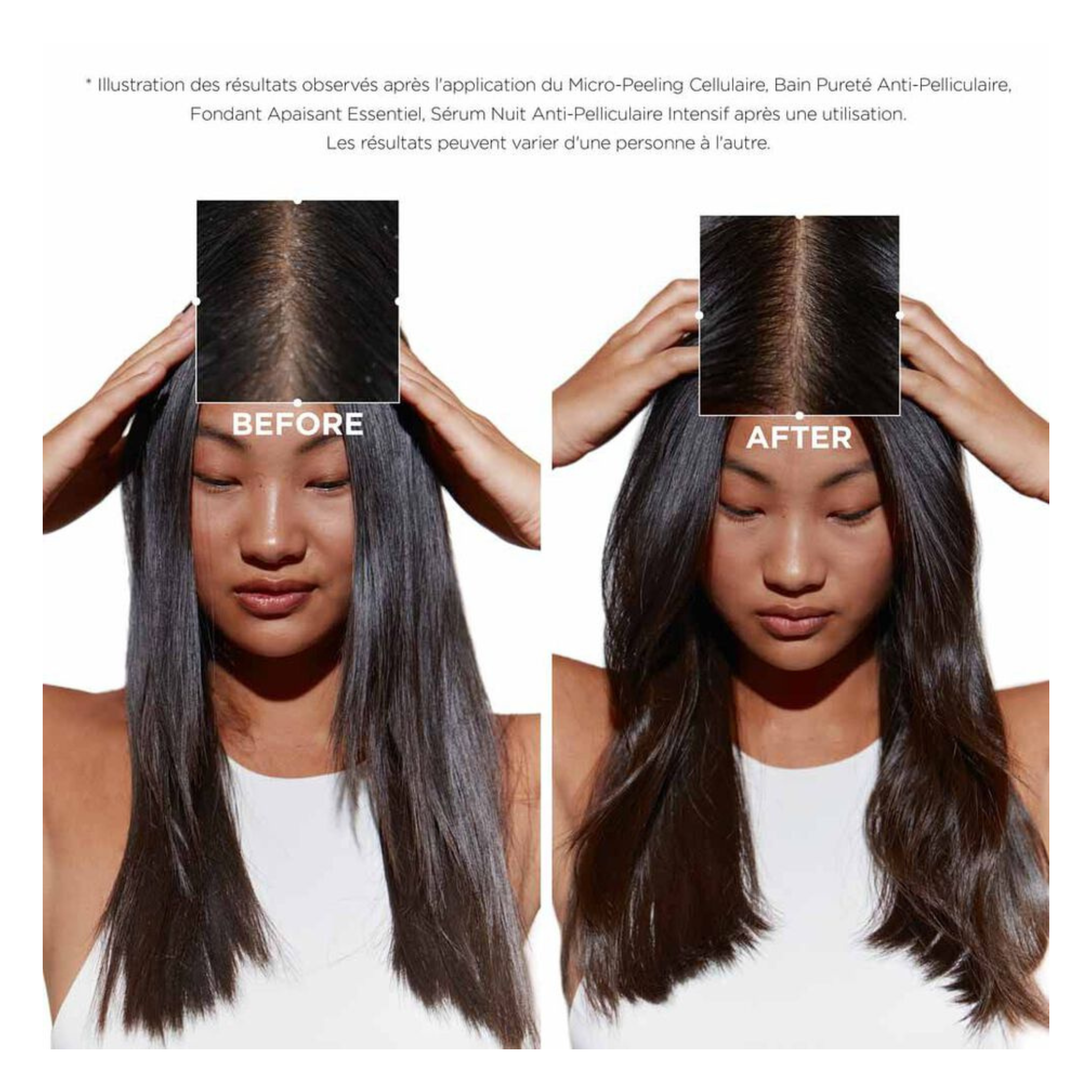 Kérastase - Fondant apaisant essentiel - 200 ML KERASTASE