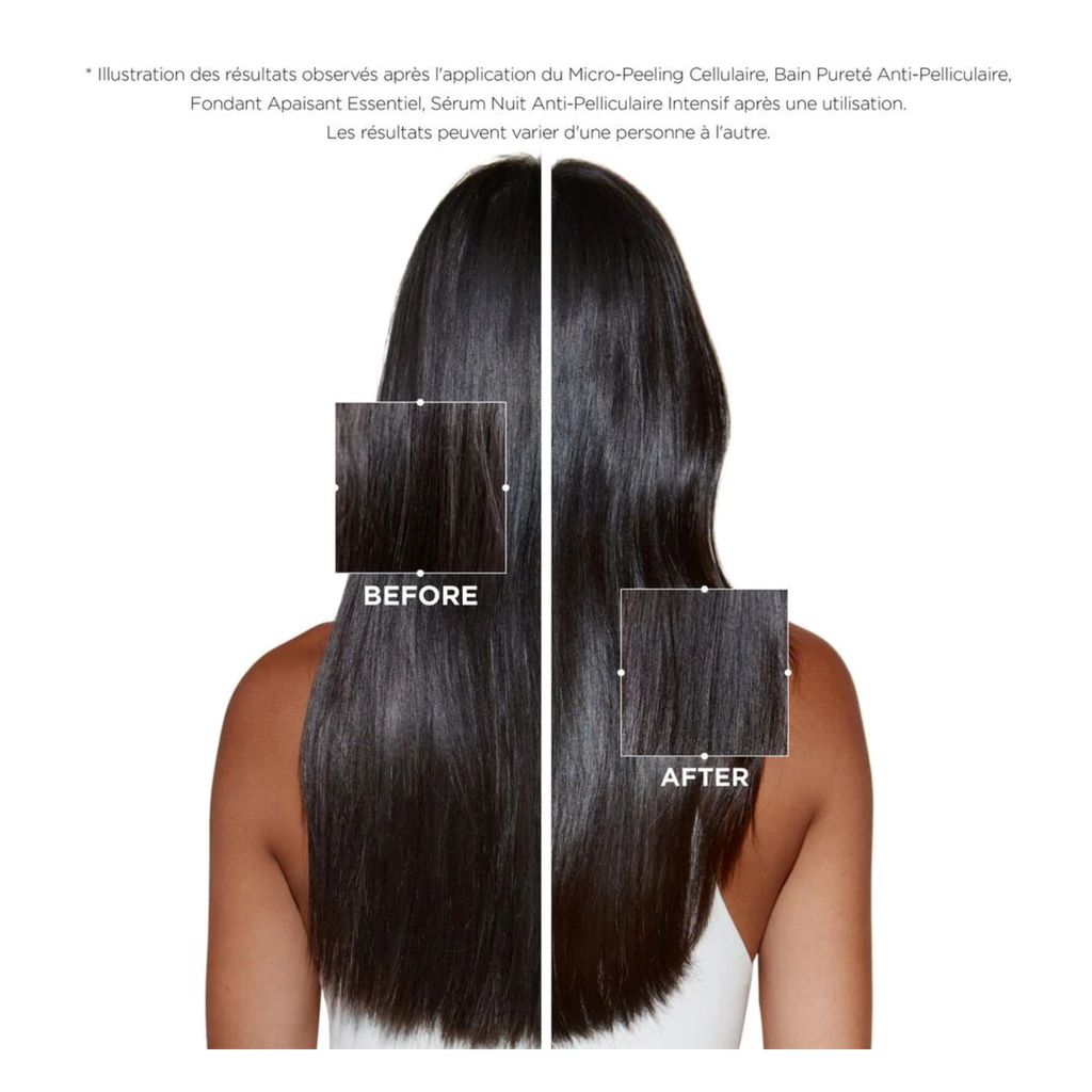 Kérastase - Fondant apaisant essentiel - 200 ML KERASTASE